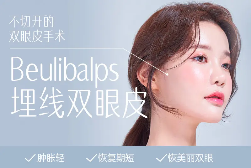 【埋线双眼皮】肿胀轻 恢复期短 美丽双眼 