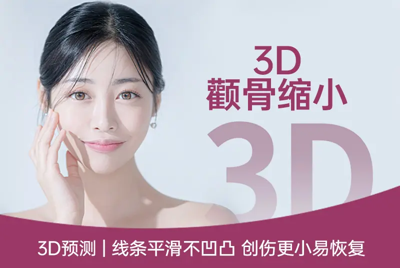 【3D颧骨缩小】线条平滑不凹凸 创伤更小易恢复