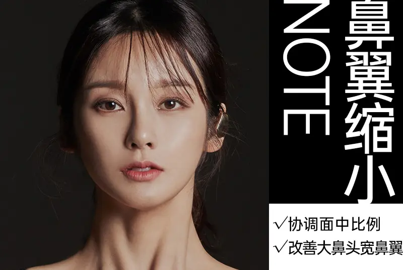 【鼻翼缩小】协调面中比例 改善大鼻头宽鼻翼 