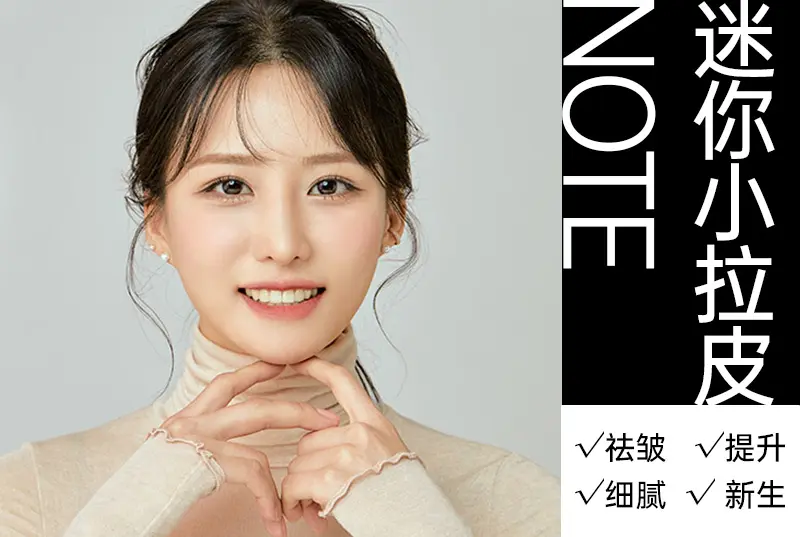 内窥镜额头提升术