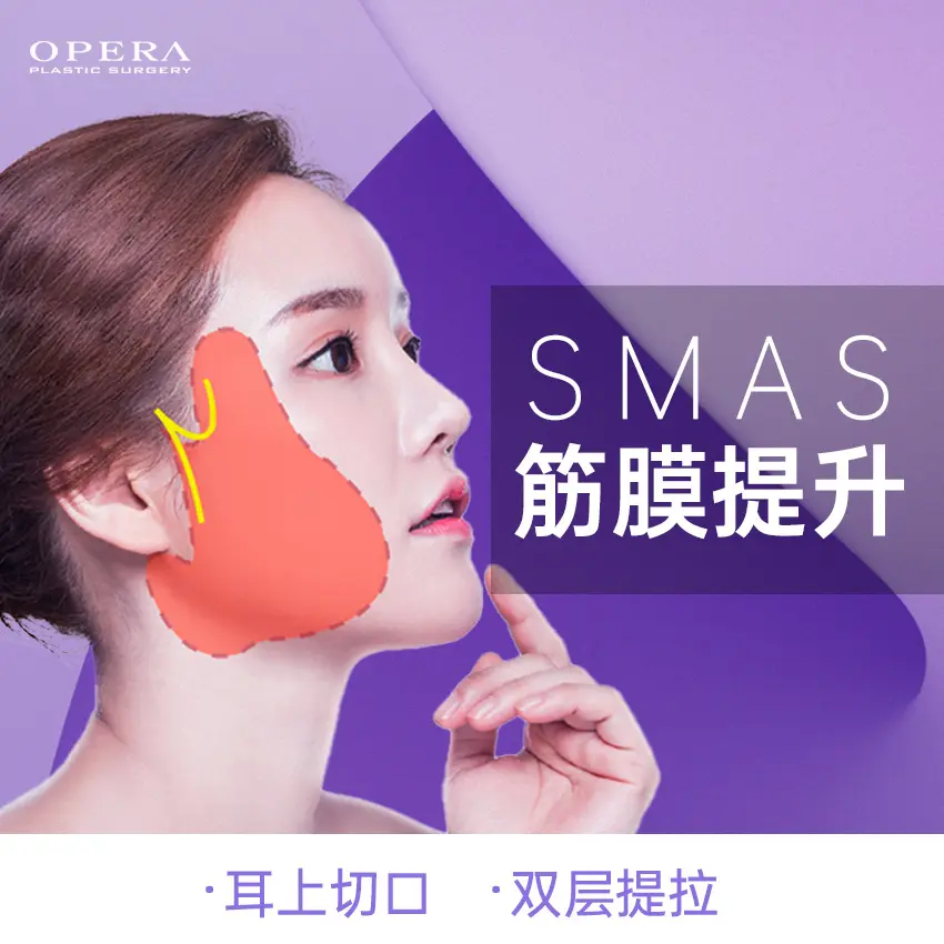 SMAS全顔リフト 1