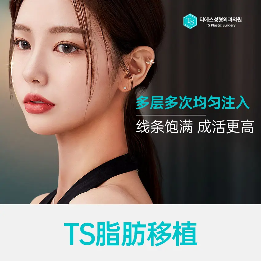 【TS FAT GRAFTING】เติมเต็มเต็มรูปแบบ ปรับรูปหน้าให้อวบอิ่มดุจเด็ก 1