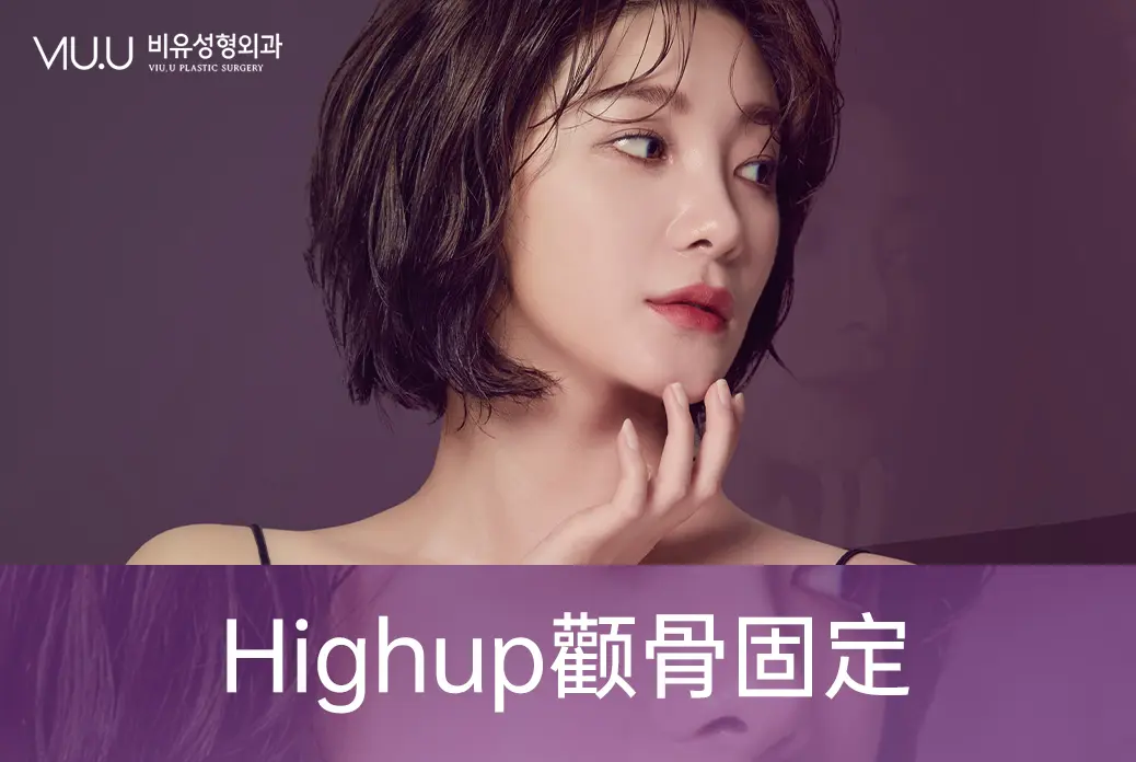 【high up 顴骨固定術】臉型更流暢 氣質更出眾