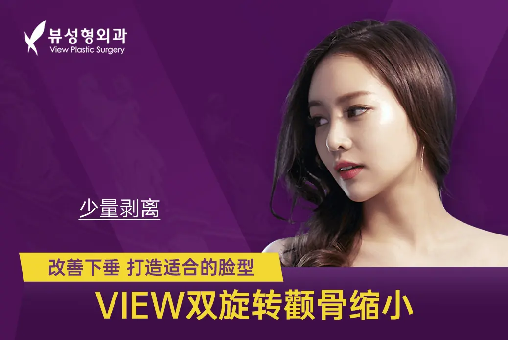 [View Dual Rotation Zygoma Reduction] Improve sagging, create a suitable face shape