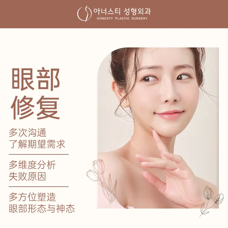 precanthal plasty 1