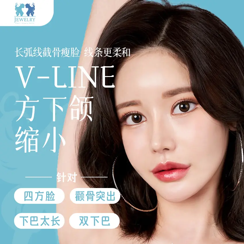 【V-LINE 方下頜縮小】長弧線截骨瘦臉 線條更柔和 1