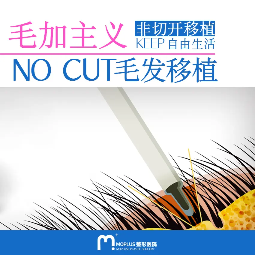 毛家毛发移植医院