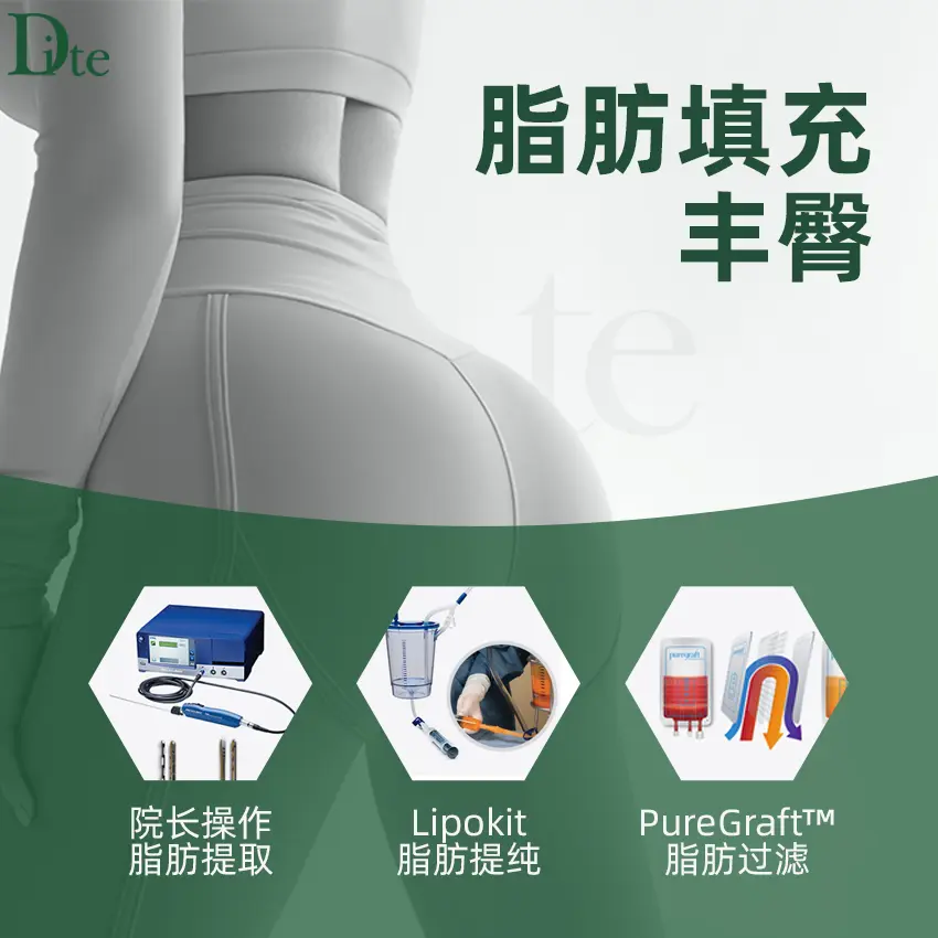 【脂肪填充豐臀】院長操作脂肪提取 Lipokit脂肪提純 1
