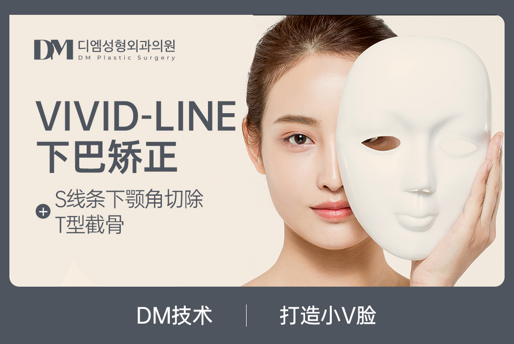 【VIVID-LINE 顎矯正】Sライン下顎角切除 T型骨切り