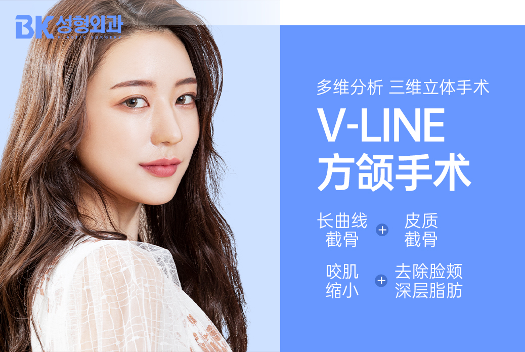 【V-LINE 方颌手术】多维分析 三维立体手术