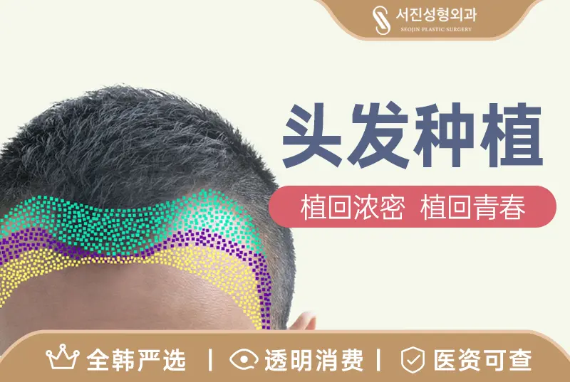 【头发种植】 植回浓密 植回青春