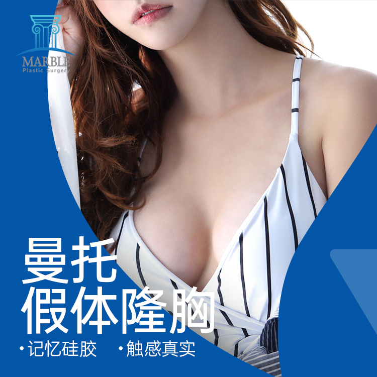 曼托假体隆胸