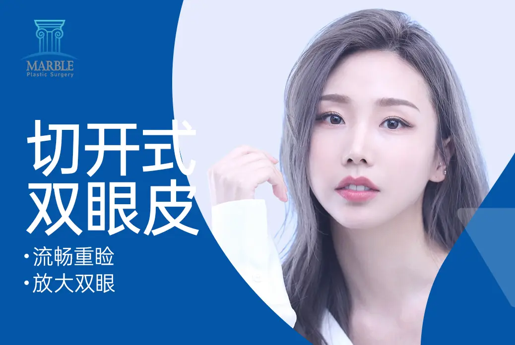【切開式雙眼皮】 流暢重瞼放大雙眼