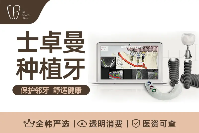 【士卓曼 种植牙】 保护邻牙 舒适健康