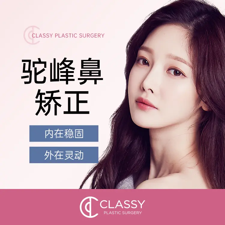 Internal stability, external agility for rhinoplasty correction 1