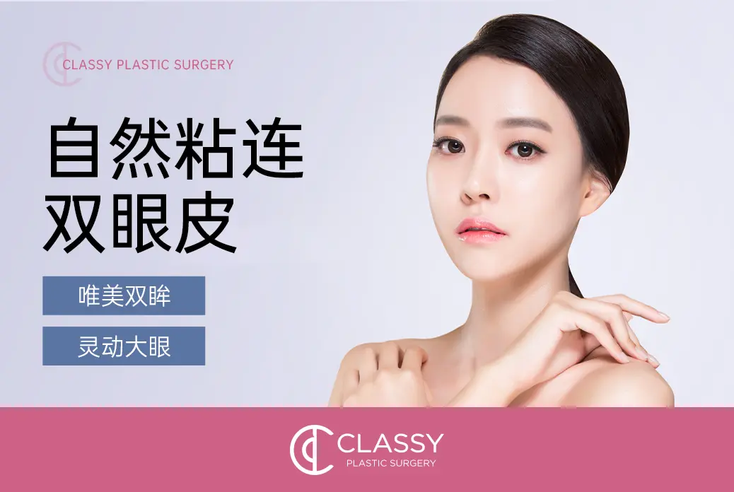 【埋线双眼皮】 唯美双眸 灵动大眼