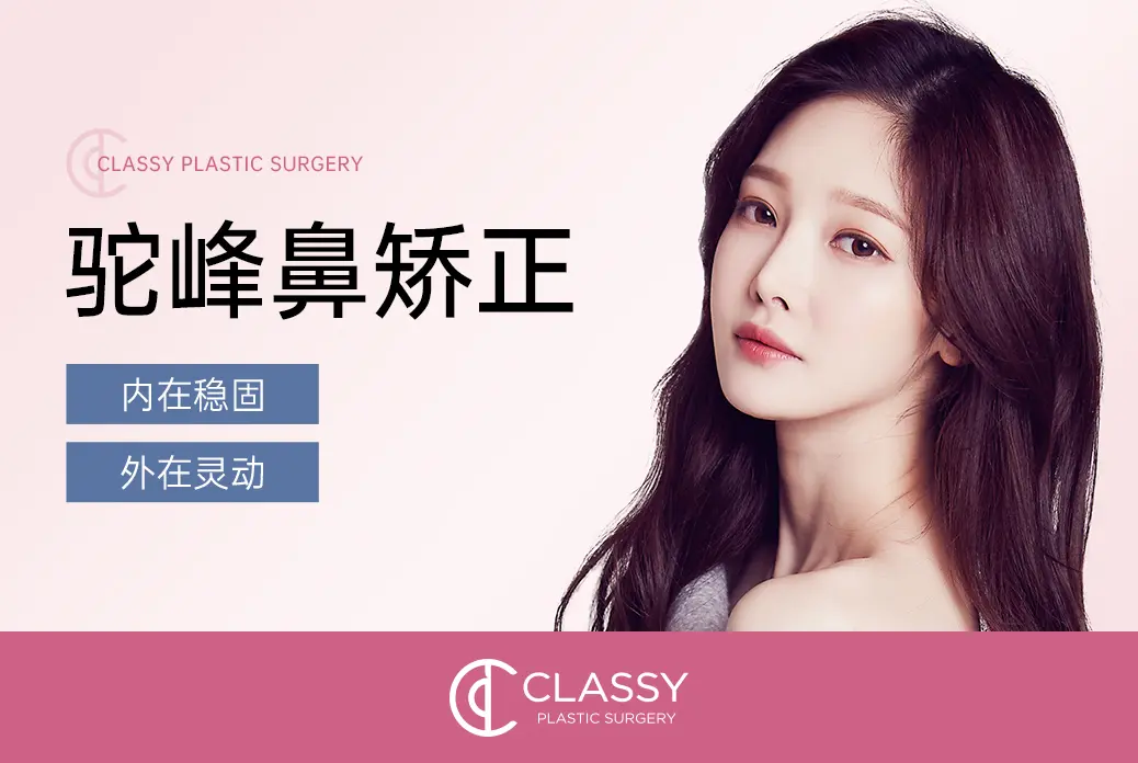 Internal stability, external agility for rhinoplasty correction