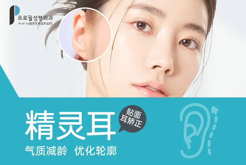 【精灵耳-贴面耳矫正】 气质减龄 优化轮廓