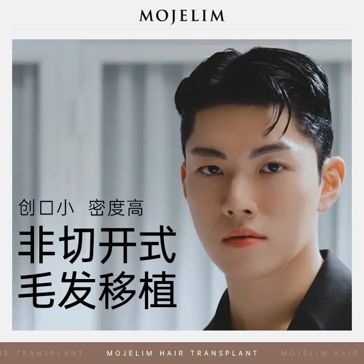 【ปลูกผมแบบไม่ผ่าตัด/ปลูกผม】แผลเล็ก ความหนาแน่นสูง 1