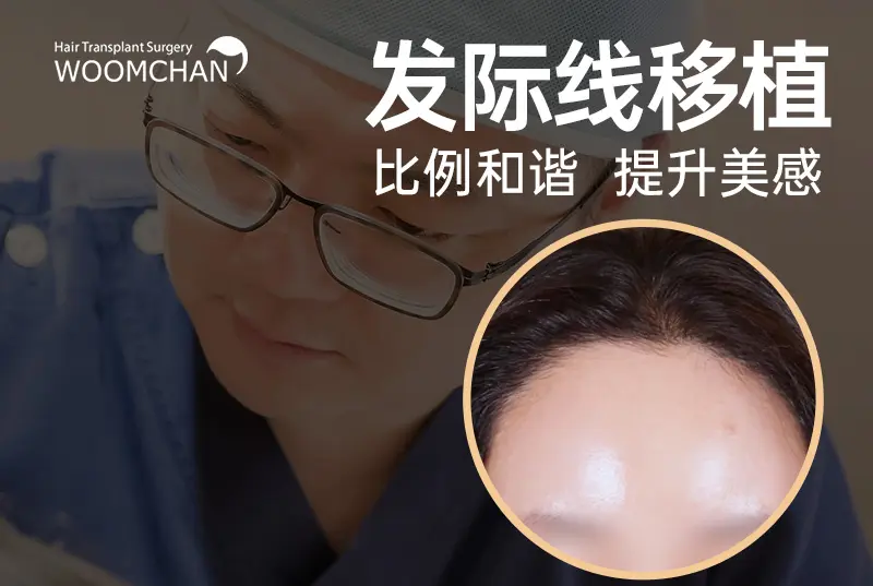 【发际线移植】比例和谐 提升美感