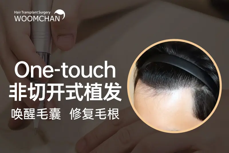 【One-touch 非切开式植发】 修复毛根 唤醒毛囊 