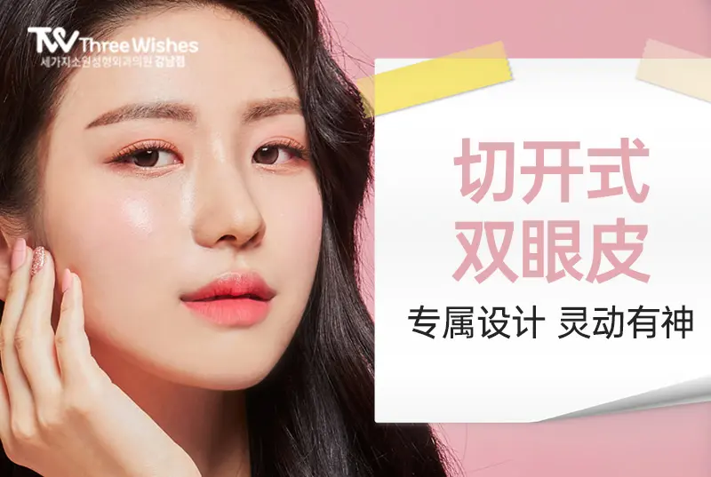 【切开式双眼皮】 专属设计 灵动有神