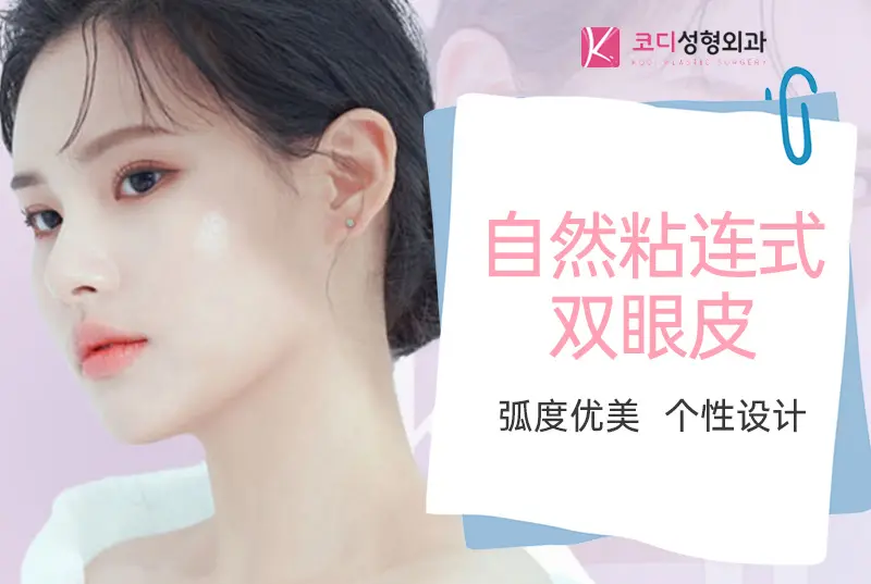 【自然粘连式双眼皮】 弧度优美 个性设计