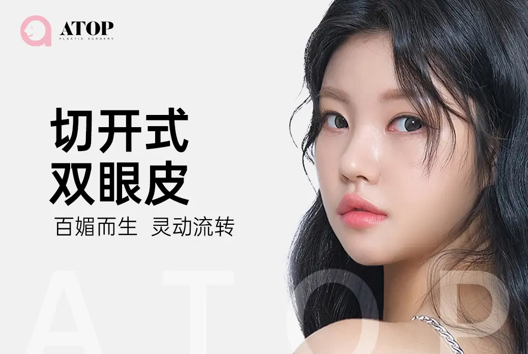 【切开式双眼皮】 百媚而生 灵动流转