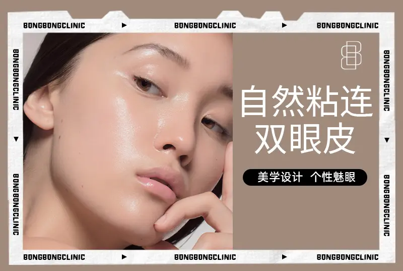 【自然粘连双眼皮】 美学设计 个性魅眼