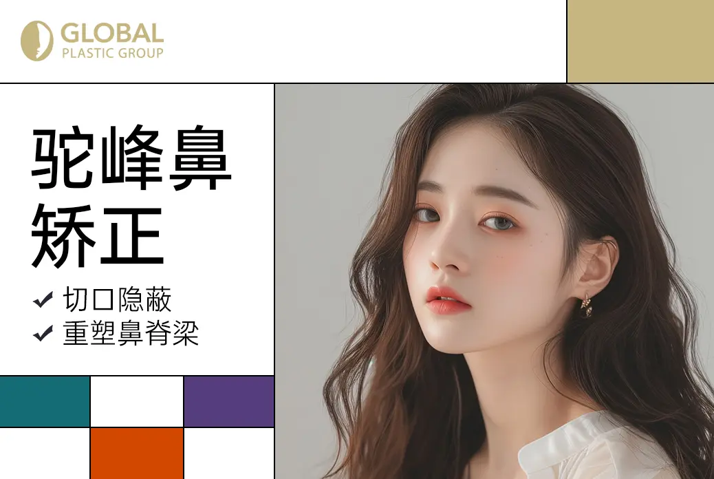 【驼峰鼻矫正】切口隐蔽  重塑鼻脊梁