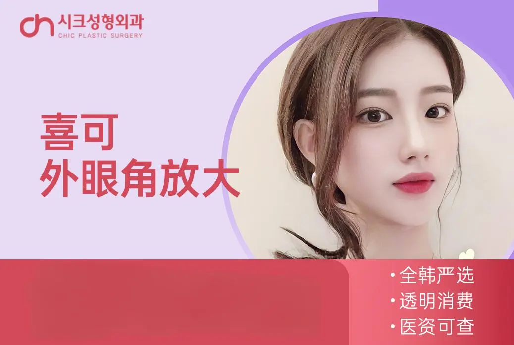【喜可外眼角放大】全韩严选 透明消费 医资可查