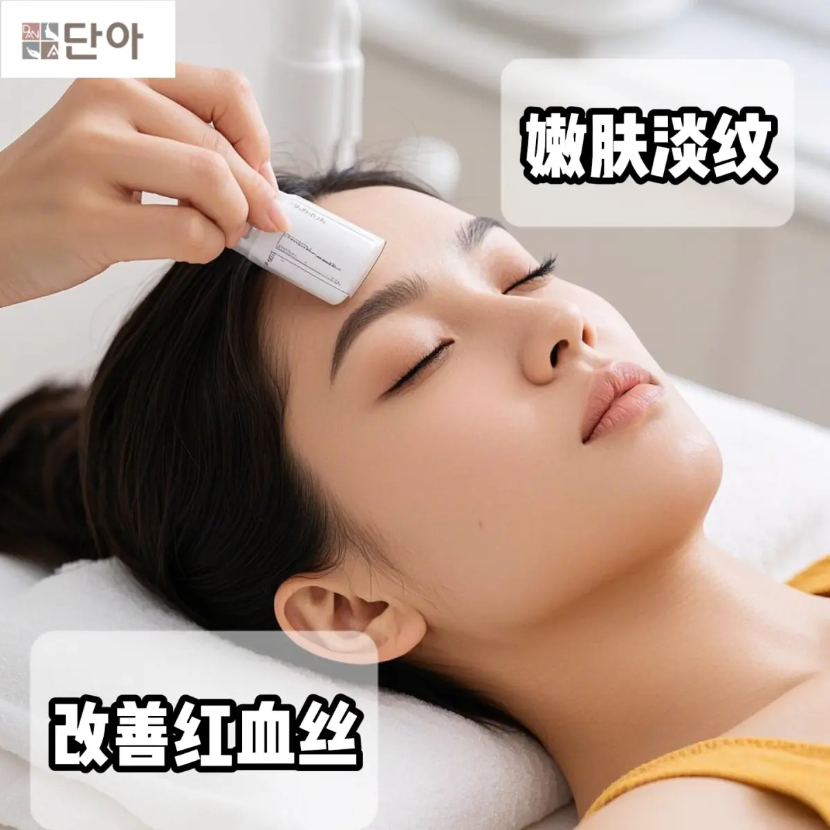 IPL（光治療）