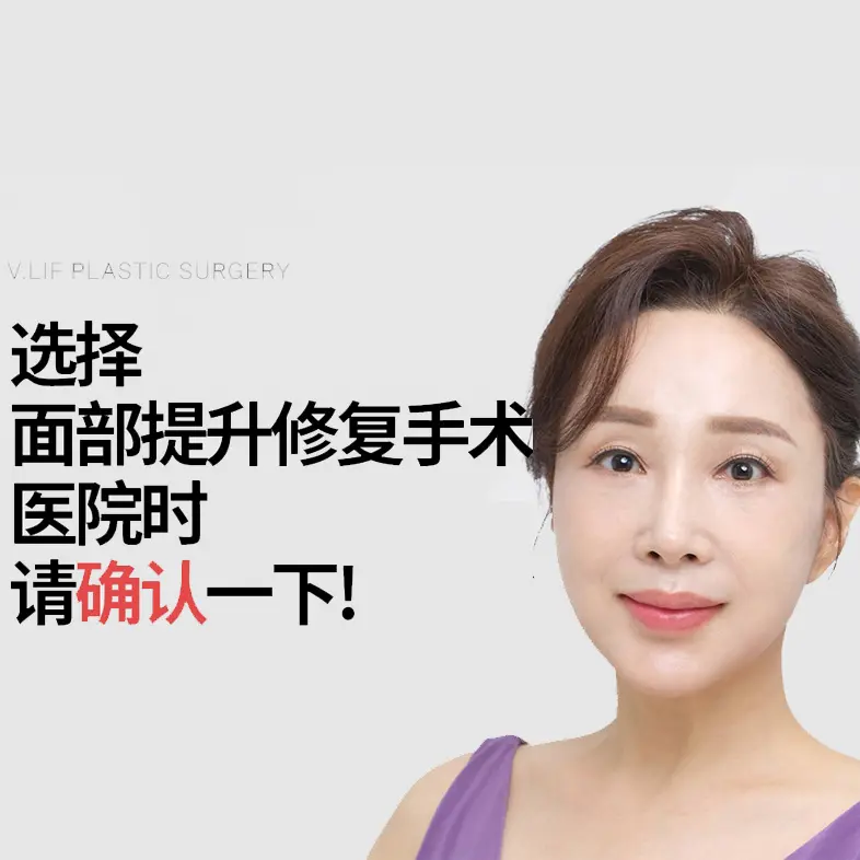 面部提升术