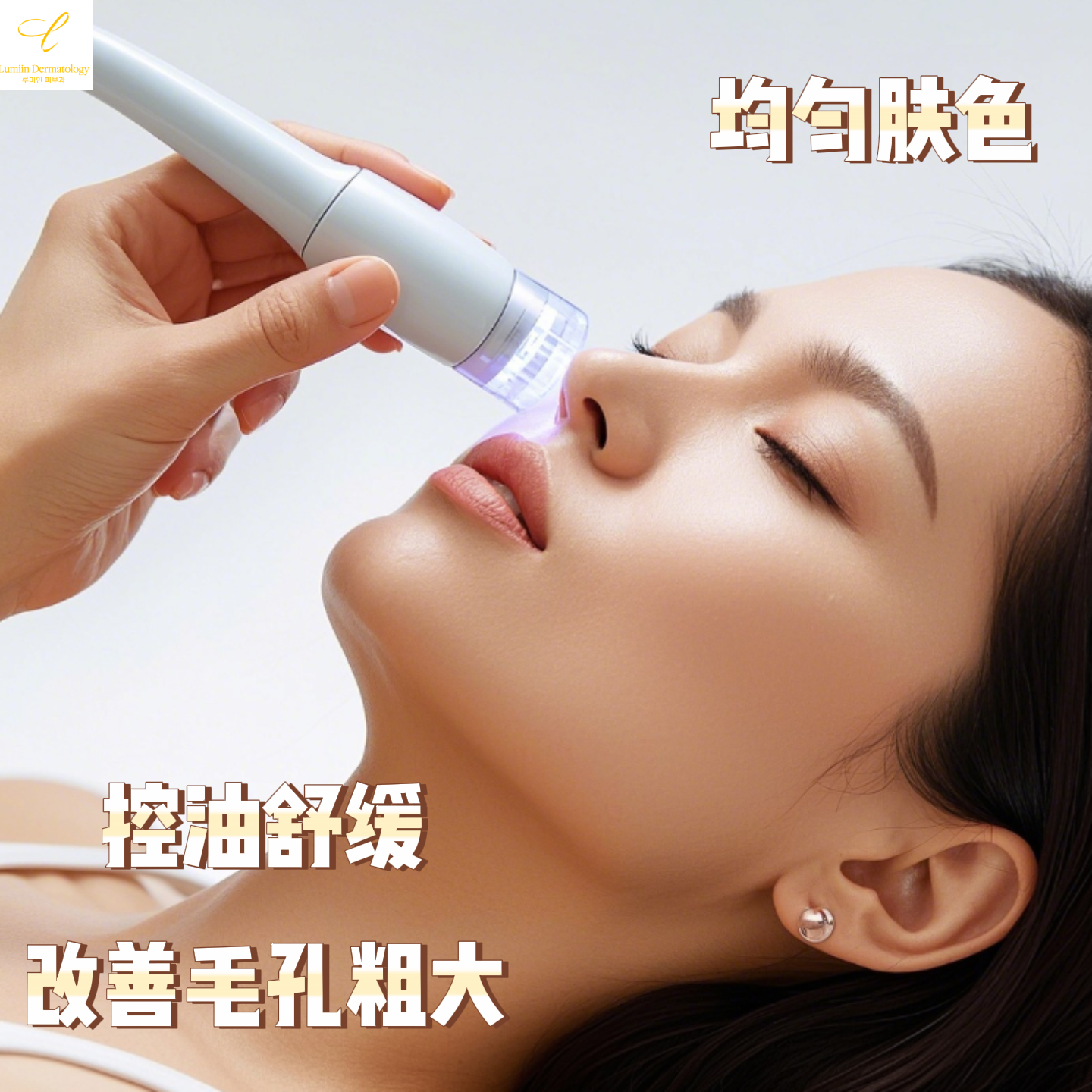 GENESIS激光(胶原蛋白/美白)