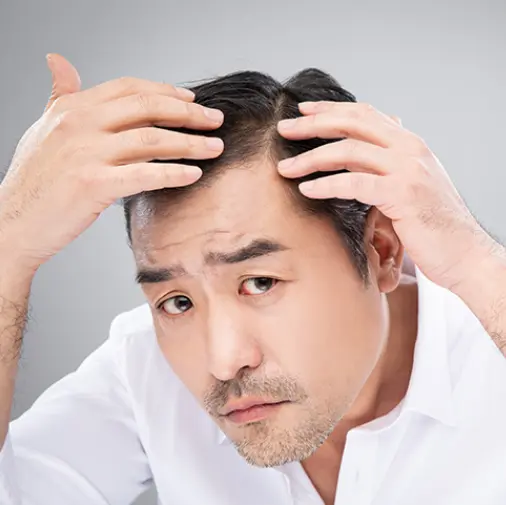 眉毛种植