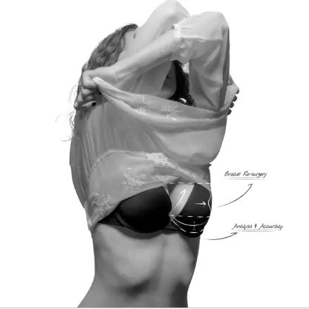 Secondary breast revision