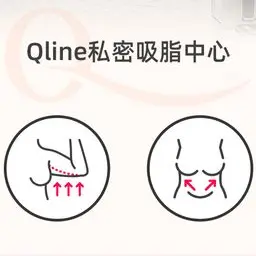 【Outer Curve Slim & Beautiful】 Cartoon legs, butterfly back, slender arms, double C-shaped waist