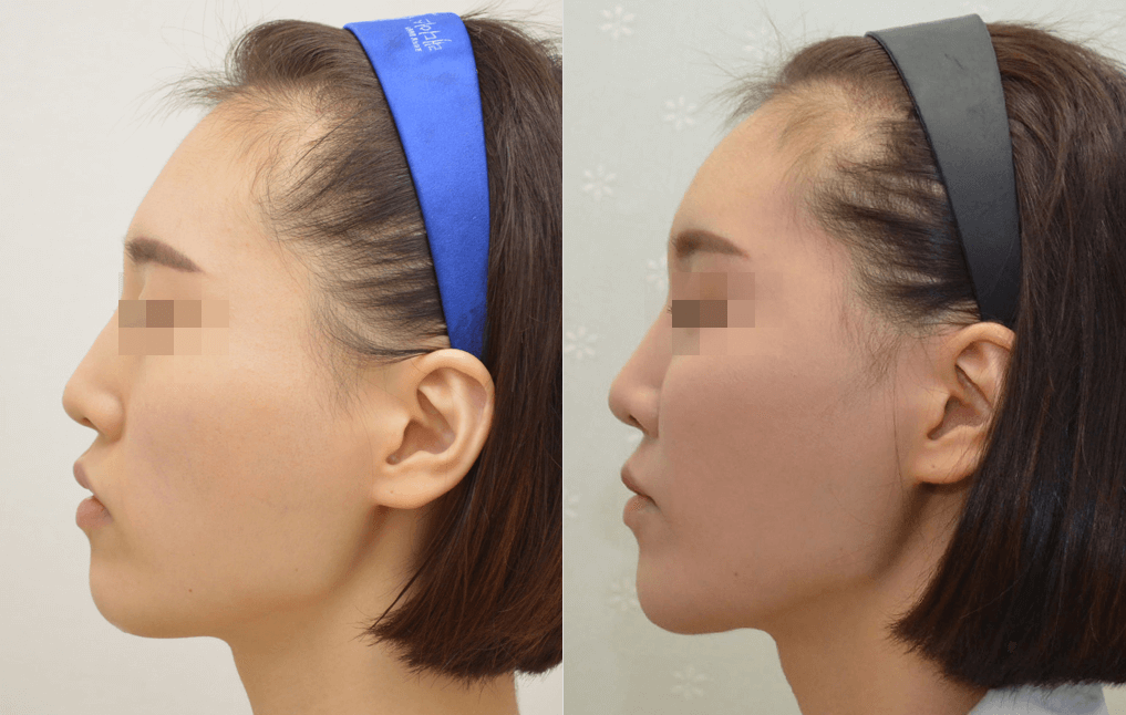 inee clinic 案例