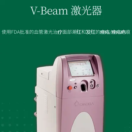 V-Beam激光器