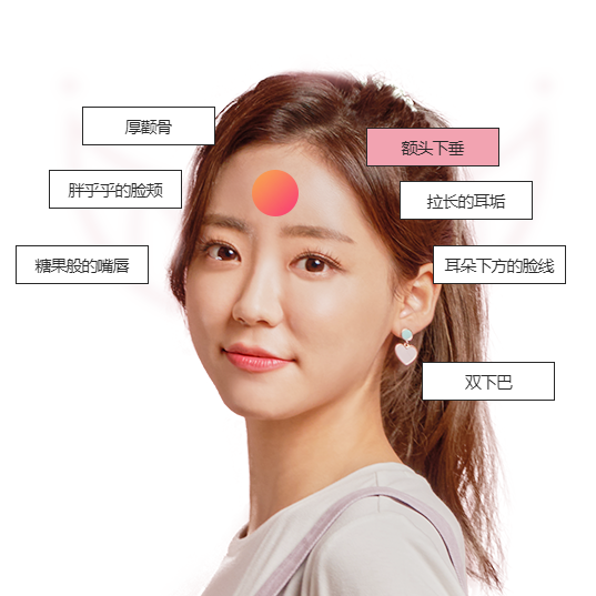 轮廓注射.png