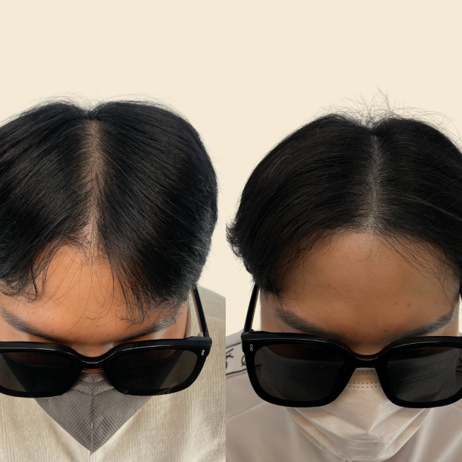 男性の分け目ヘアスタイル