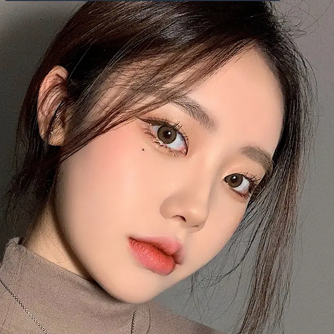 Sutured Double eyelid surgery