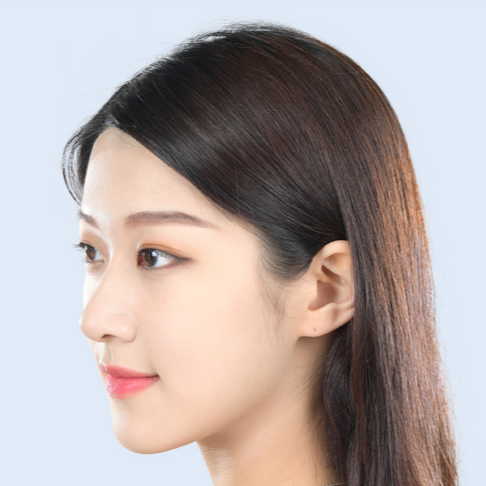 鼻部缩小术
