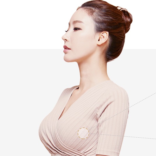 乳房缩小术