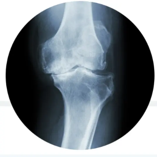 Regeneration of a single knee cell