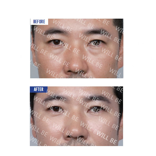 Will Be Plastic Surgery 案例
