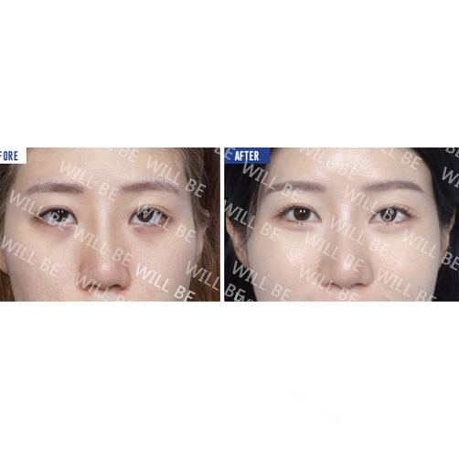 Will Be Plastic Surgery 案例