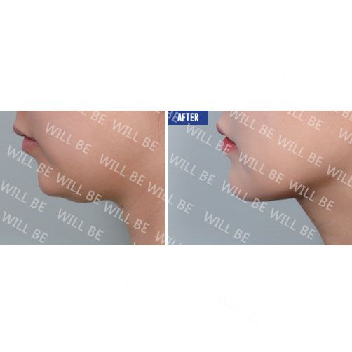 Will Be Plastic Surgery 案例