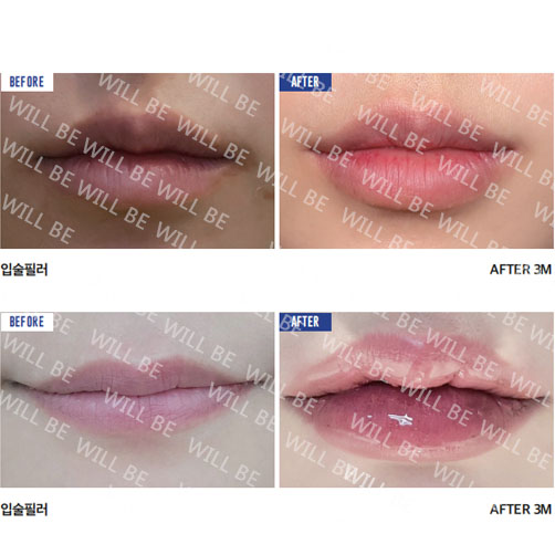 Will Be Plastic Surgery 案例