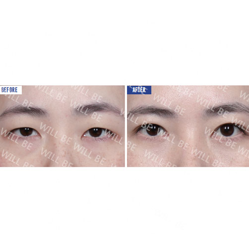Will Be Plastic Surgery 案例